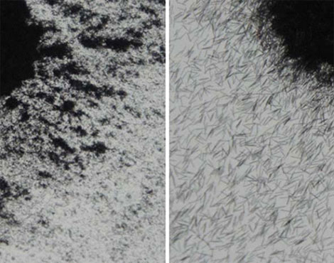 THK Hair under magnification shows fibre advancement